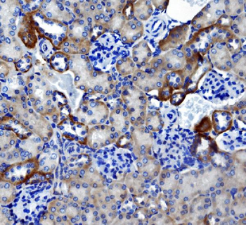 Carbonic Anhydrase 4/CA4 Rabbit Polyclonal Antibody
