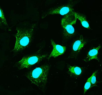 CARD9 Rabbit Polyclonal Antibody