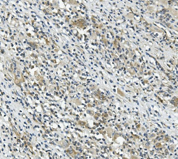 CARD9 Rabbit Polyclonal Antibody