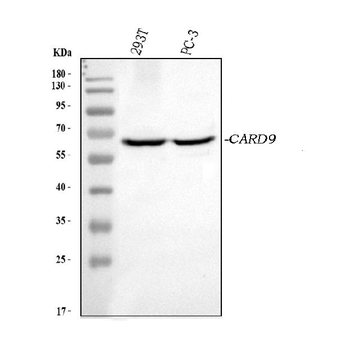 CARD9 Rabbit Polyclonal Antibody