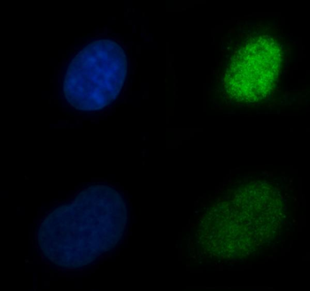 CBR1 Antibody