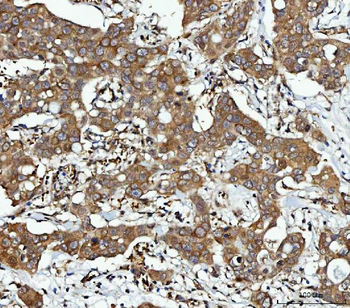 CBR1 Antibody
