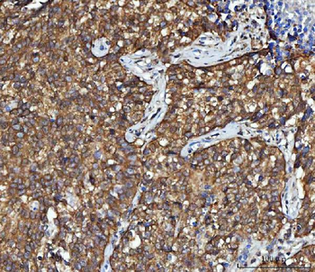 CBR1 Antibody