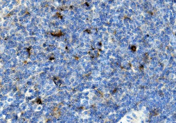 CCR2 Antibody