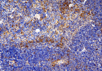 CCR6 Antibody