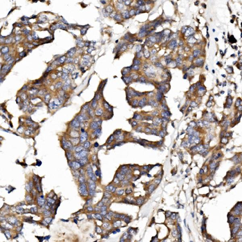 Band 4.1-like protein 5 EPB41L5 Rabbit Polyclonal Antibody