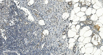 FLCN Antibody