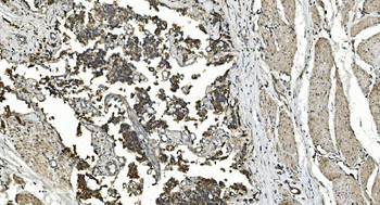 FLCN Antibody