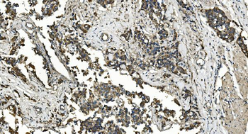 FLCN Antibody