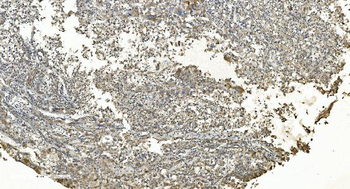 FLCN Antibody