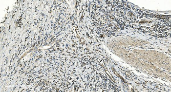 FLCN Antibody