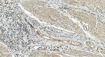 FLCN Antibody
