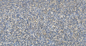 FLCN Antibody