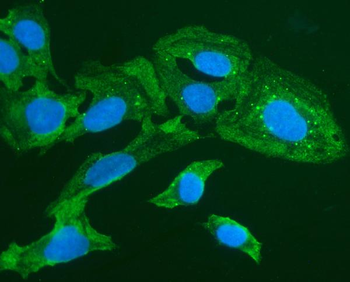 Forkhead box protein I1 FOXI1 Rabbit Polyclonal Antibody