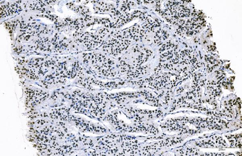 FOXK1/MNF Antibody