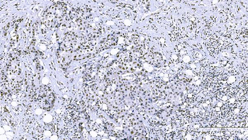 FOXK1/MNF Antibody