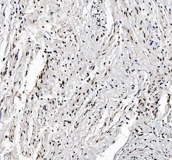 FOXK1/MNF Antibody