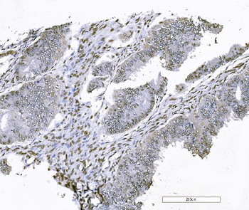 FOXK1/MNF Antibody