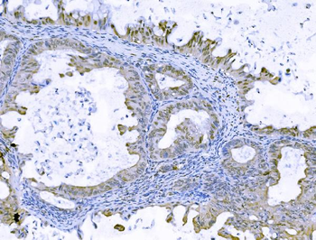 FOXK1/MNF Antibody