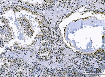FOXK1/MNF Antibody