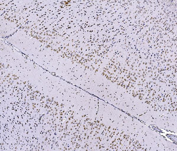 FOXK1/MNF Antibody