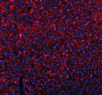 Mannose Receptor/MRC1 Antibody