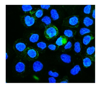 PICALM Rabbit Polyclonal Antibody