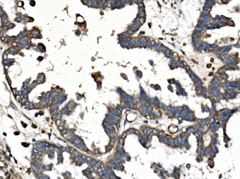 PICALM Rabbit Polyclonal Antibody