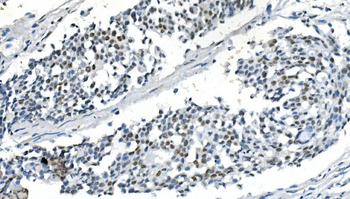 PPM1A Rabbit Polyclonal Antibody