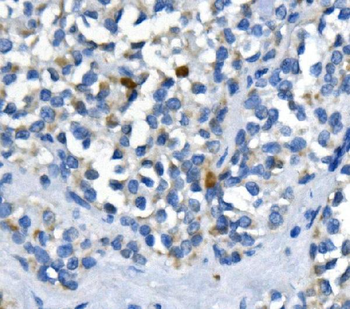 PPM1A Rabbit Polyclonal Antibody