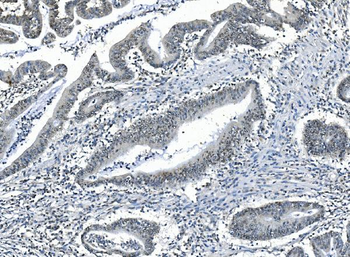 PPM1A Rabbit Polyclonal Antibody