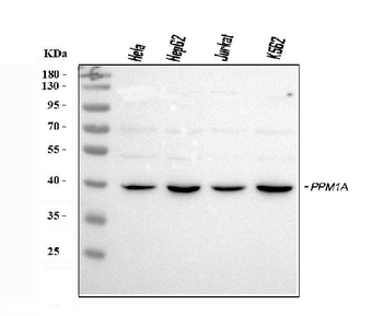 PPM1A Rabbit Polyclonal Antibody