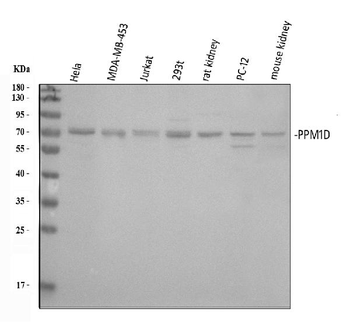 PPM1D/WIP1 Picoband® Rabbit Polyclonal Antibody