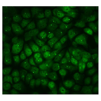 PPM1E Rabbit Polyclonal Antibody