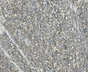 PPM1E Rabbit Polyclonal Antibody