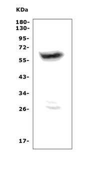 PRAME Rabbit Polyclonal Antibody