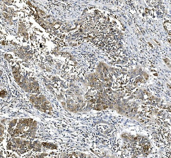 COX2/Cyclooxygenase 2/PTGS2 Rabbit Polyclonal Antibody