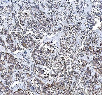 COX2/Cyclooxygenase 2/PTGS2 Rabbit Polyclonal Antibody