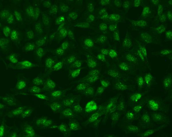 RNF168 Rabbit Polyclonal Antibody