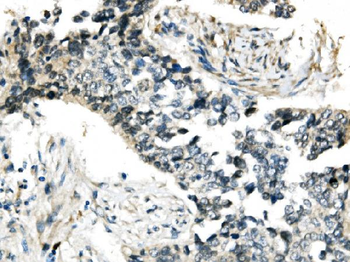 RNF168 Rabbit Polyclonal Antibody