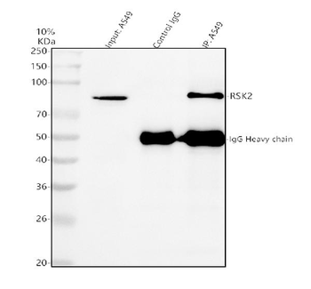 Rsk 2/MAPKAP Kinase 1b/RPS6KA3 Antibody