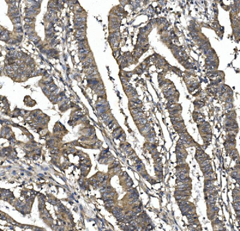 SORBS1 Rabbit Polyclonal Antibody