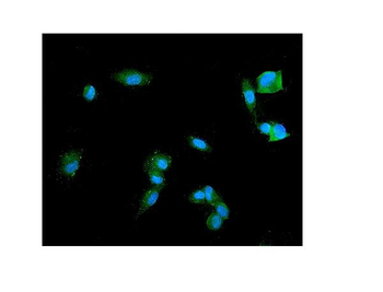 Synaptophysin/SYP Antibody