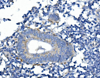 Synaptophysin/SYP Antibody