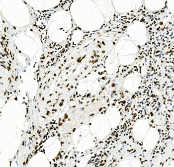 KAP1/TRIM28 Antibody (monoclonal, 3H2)