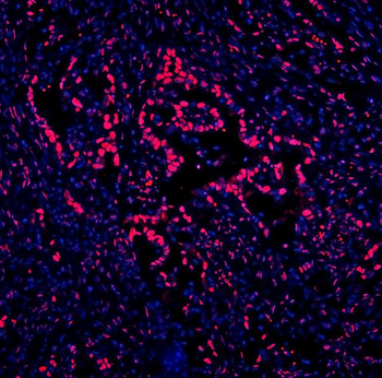 DDX5 Antibody (monoclonal, 3F9)