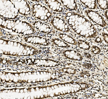 DDX5 Antibody (monoclonal, 3F9)