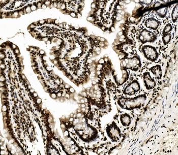 DDX5 Antibody (monoclonal, 3F9)