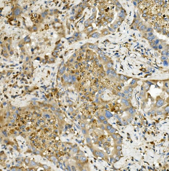 Hexokinase 1/HK1 Mouse Monoclonal Antibody
