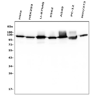 Hexokinase 1/HK1 Mouse Monoclonal Antibody